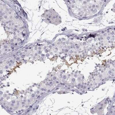 Immunohistochemistry-Paraffin: HEATR8 Antibody [NBP2-62673] - Staining of human testis shows high expression.