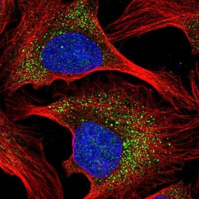 Immunocytochemistry/Immunofluorescence: HEBP1 Antibody [NBP2-49224] - Staining of human cell line U-2 OS shows localization to nucleus & vesicles.