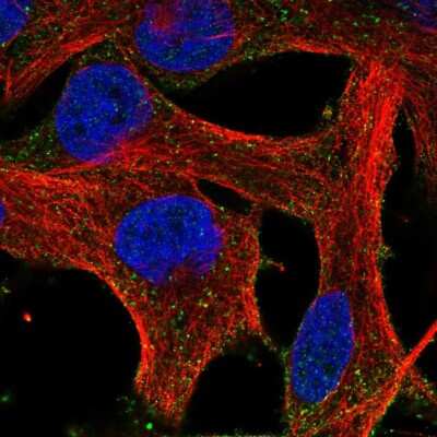 Immunocytochemistry/Immunofluorescence: HEBP1 Antibody [NBP2-57944] - Staining of human cell line SK-MEL-30 shows localization to vesicles.