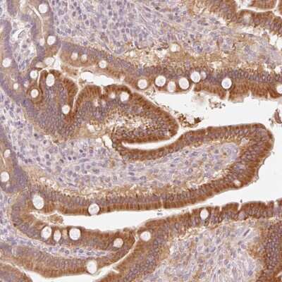 Immunohistochemistry: HEBP1 Antibody [NBP2-49224] - Staining of human duodenum shows strong cytoplasmic positivity in glandular cells.