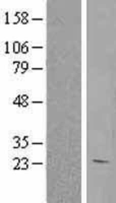 Western Blot: HEBP1 Overexpression Lysate (Adult Normal) [NBL1-11497] Left-Empty vector transfected control cell lysate (HEK293 cell lysate); Right -Over-expression Lysate for HEBP1.