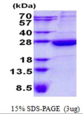 SDS-Page: HEBP1 Protein [NBP2-23109]