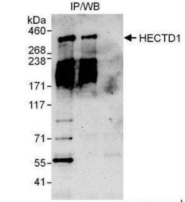 <b>Independent Antibodies Validation and Biological Strategies Validation.</b>Immunoprecipitation: HECTD1 Antibody [NBP1-49926] - Detection of Human HECTD1 by Western Blot of Immunoprecipitates. Samples:  Whole cell lysate (1 mg for IP, 20% of IP loaded) from HeLa cells.  Antibodies: Affinity purified rabbit anti-HECTD1 antibody used for IP at 3 mcg/mg lysate.  HECTD1 was also immunoprecipitated by rabbit anti-HECTD1 antibody which recognizes an upstream epitope.  For blotting immunoprecipitated HECTD1 was used at 1 mcg/ml. Detection: Chemiluminescence with an exposure time of 3 minutes.