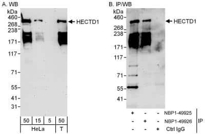 Western Blot: HECTD1 Antibody [NBP1-49925] - Samples:  Whole cell lysate from HeLa (5, 15 and 50 ug for WB; 1 mg for IP, 20% of IP loaded) and 293T (T; 50 ug) cells.  Antibodies: Affinity purified rabbit anti-HECTD1 antibody NBP1-49925 used for WB at 0.1 ug/ml (A) and 1 ug/ml (B) and used for IP at 3 ug/mg lysate.  HECTD1 was also immunoprecipitated by rabbit anti-HECTD1 antibody NBP1-49926, which recognizes a downstream epitope.   Detection: Chemiluminescence with exposure times of 3 minutes (A and B).