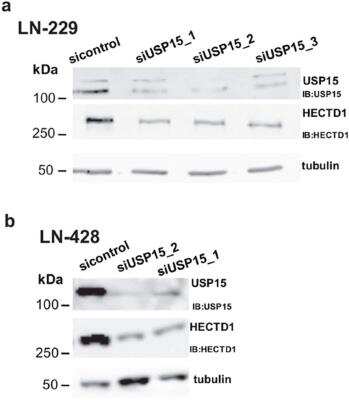 Western Blot: HECTD1 Antibody [NBP1-49926] - USP15 knockdown with three siRNAs in LN-229 and (b) two siRNAs in LN-428. Image collected and cropped by CiteAb from the following publication (//www.oncotarget.com/lookup/doi/10.18632/oncotarget.22798) licensed under a CC-BY license. USP15 antibody (catalog # NB110-40690)