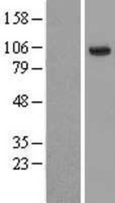 Western Blot: HECTD3 Overexpression Lysate (Adult Normal) [NBL1-11500] Left-Empty vector transfected control cell lysate (HEK293 cell lysate); Right -Over-expression Lysate for HECTD3.
