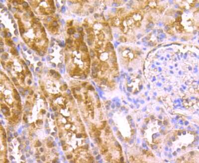 Immunohistochemistry-Paraffin: HECTD4 Antibody (A2-F5-F10) [NBP2-75411] - Analysis of paraffin-embedded human kidney tissue using anti-C12orf51 antibody. Counter stained with hematoxylin.