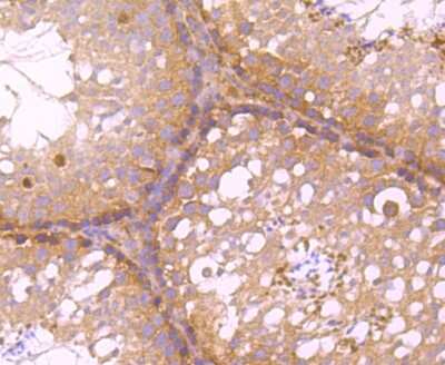 Immunohistochemistry-Paraffin: HECTD4 Antibody (A2-F5-F10) [NBP2-75411] - Analysis of paraffin-embedded mouse testis tissue using anti-C12orf51 antibody. Counter stained with hematoxylin.