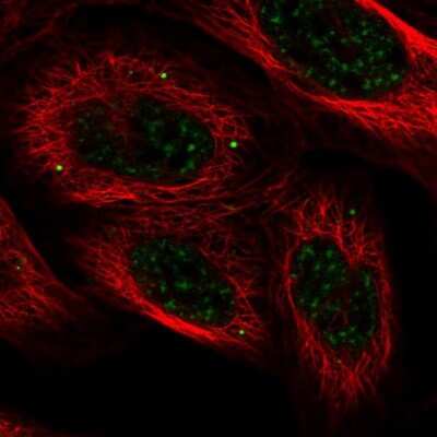 Immunocytochemistry/ Immunofluorescence HECTD4 Antibody - BSA Free