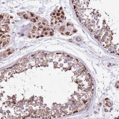 Immunohistochemistry-Paraffin: HECTD4 Antibody [NBP2-30697] - Staining of human testis shows cytoplasmic positivity in cells in seminiferous ducts and Leydig cells.