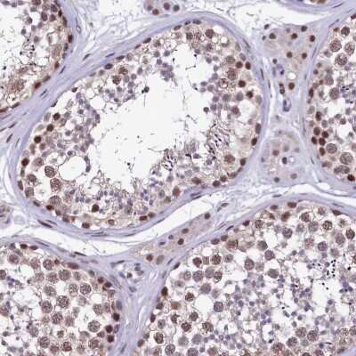 Immunohistochemistry-Paraffin HECTD4 Antibody - BSA Free