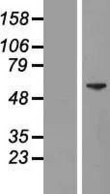 Western Blot: HELIOS Overexpression Lysate (Adult Normal) [NBL1-11892] Left-Empty vector transfected control cell lysate (HEK293 cell lysate); Right -Over-expression Lysate for HELIOS.