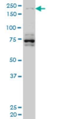 Western Blot: HELZ Antibody (5B2) [H00009931-M02] - HELZ monoclonal antibody (M02), clone 5B2 Analysis of HELZ expression in Hela S3 NE.