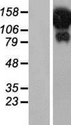 Western Blot HELZ Overexpression Lysate