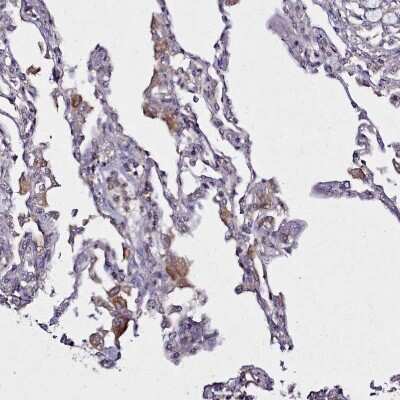 Immunohistochemistry-Paraffin HEM1 Antibody