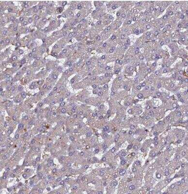 Immunohistochemistry-Paraffin HEM1 Antibody