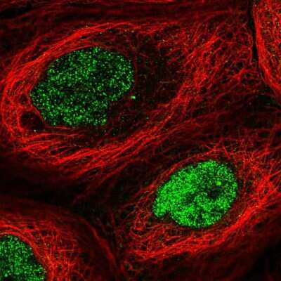 Immunocytochemistry/Immunofluorescence: HEMK2 Antibody [NBP2-57126] - Staining of human cell line A-431 shows localization to nucleoplasm & centrosome. Antibody staining is shown in green.
