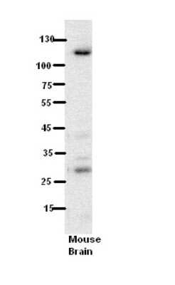 Western Blot: HEMK2 Antibody [NBP1-56486] - Mouse Brain lysate, concentration 5% Milk.