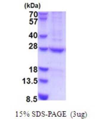 SDS-Page: HEMK2 Recombinant Protein [NBP2-51881] - 15% SDS Page (3 ug)