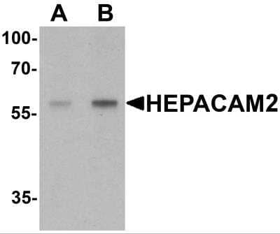 Western Blot: HEPACAM2 Antibody - BSA Free [NBP2-81720] - Analysis of HEPACAM2 in mouse brain tissue lysate with HEPACAM2 antibody at (A) 0.5 and (B) 1 ug/ml.