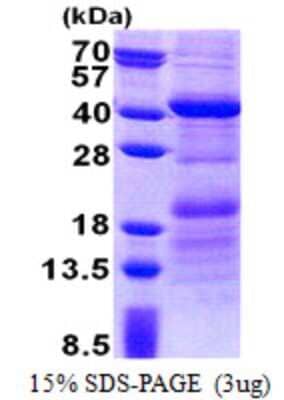 SDS-Page: HEPACAM2 Protein [NBP2-23115]