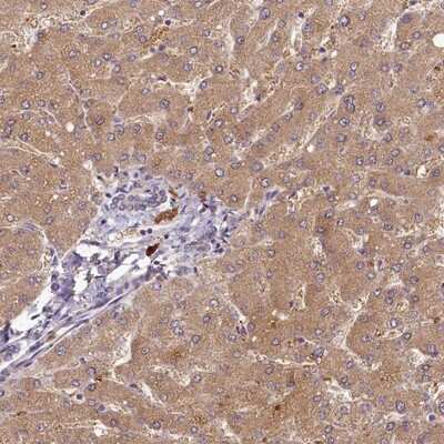 Immunohistochemistry-Paraffin: HERC3 Antibody [NBP1-81553] - Staining of human liver shows moderate cytoplasmic positivity in hepatocytes.