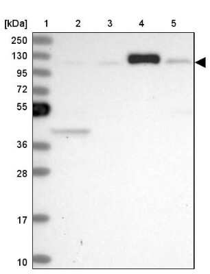 Western Blot: HERC3 Antibody [NBP1-81553] - Lane 1: Marker  [kDa] 250, 130, 95, 72, 55, 36, 28, 17, 10.  Lane 2: Human cell line RT-4.  Lane 3: Human cell line U-251MG sp.  Lane 4: Human plasma (IgG/HSA depleted).  Lane 5: Human liver tissue