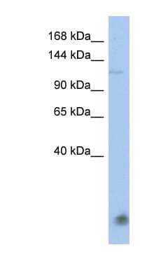 Western Blot: HERC5 Antibody [NBP1-58101] - Titration: 0.2-1 ug/ml, Positive Control: HT1080 cell lysate.