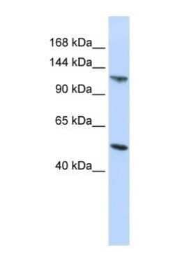 Western Blot: HERC5 Antibody [NBP1-58102] - Titration: 0.2-1 ug/ml ELISA Titer: 1:312500 Positive Control: HepG2 cell lysate