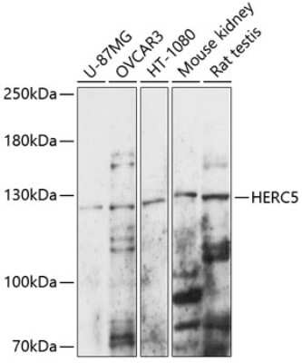 Western Blot: HERC5 Antibody [NBP3-04987] - Analysis of extracts of various cell lines, using HERC5 antibody at 1:1000 dilution. Secondary antibody: HRP Goat Anti-Rabbit IgG (H+L) at 1:10000 dilution. Lysates/proteins: 25ug per lane. Blocking buffer: 3% nonfat dry milk in TBST. Detection: ECL Basic Kit