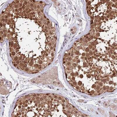 Immunohistochemistry-Paraffin: HERPUD1 Antibody [NBP1-83268] - Staining of human testis shows strong cytoplasmic and nuclear positivity in cells in seminiferus ducts.