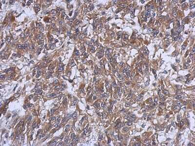 Immunohistochemistry-Paraffin: HERPUD1 Antibody [NBP2-16809] -  U251 xenograft, using HERPUD1 antibody at 1:500 dilution. Antigen Retrieval: Trilogy™ (EDTA based, pH 8.0) buffer, 15min. 