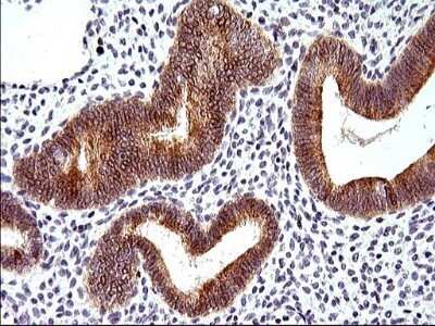 Immunohistochemistry: HERPUD1 Antibody (OTI1A2) - Azide and BSA Free [NBP2-71492] - Analysis of Human endometrium tissue. (Heat-induced epitope retrieval by 1 mM EDTA in 10mM Tris, pH8.5, 120C for 3min)