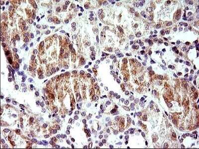 Immunohistochemistry: HERPUD1 Antibody (OTI1A2) - Azide and BSA Free [NBP2-71492] - Analysis of Human Kidney tissue. (Heat-induced epitope retrieval by 1 mM EDTA in 10mM Tris, pH8.5, 120C for 3min)