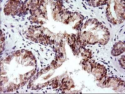 Immunohistochemistry: HERPUD1 Antibody (OTI1A2) - Azide and BSA Free [NBP2-71492] - Analysis of Human prostate tissue. (Heat-induced epitope retrieval by 1 mM EDTA in 10mM Tris, pH8.5, 120C for 3min)