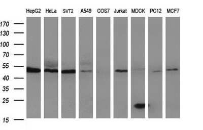 Western Blot: HERPUD1 Antibody (OTI1A2) - Azide and BSA Free [NBP2-71492] - Analysis of extracts (35ug) from 9 different cell lines by using HERPUD1 monoclonal antibody (HepG2: human; HeLa: human; SVT2: mouse; A549: human; COS7: monkey; Jurkat: human; MDCK: canine; PC12: rat; MCF7: human).