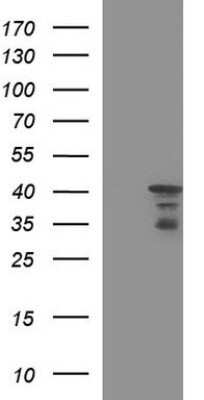 Western Blot: HERPUD1 Antibody (OTI1A2) - Azide and BSA Free [NBP2-71492] - Analysis of HEK293T cells were transfected with the pCMV6-ENTRY control (Left lane) or pCMV6-ENTRY HERPUD1.