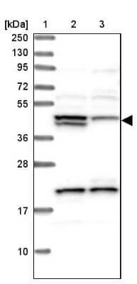 Western Blot: HERPUD1 Antibody [NBP1-83267] - Lane 1: Marker  [kDa] 250, 130, 95, 72, 55, 36, 28, 17, 10.  Lane 2: Human cell line RT-4.  Lane 3: Human cell line U-251MG sp