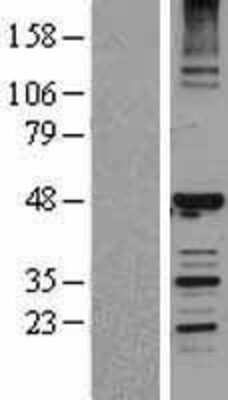 Western Blot: HERPUD1 Overexpression Lysate (Adult Normal) [NBL1-11508] Left-Empty vector transfected control cell lysate (HEK293 cell lysate); Right -Over-expression Lysate for HERPUD1.