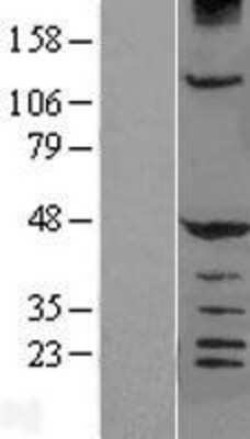 Western Blot: HERPUD1 Overexpression Lysate (Adult Normal) [NBL1-11509] Left-Empty vector transfected control cell lysate (HEK293 cell lysate); Right -Over-expression Lysate for HERPUD1.