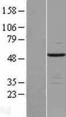 Western Blot: HERPUD2 Overexpression Lysate (Adult Normal) [NBL1-11510] Left-Empty vector transfected control cell lysate (HEK293 cell lysate); Right -Over-expression Lysate for HERPUD2.