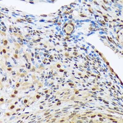 Immunohistochemistry-Paraffin: HES5 Antibody (4S4U7) [NBP3-16880] - Rat ovary using HES5 Rabbit mAb (NBP3-16880) at dilution of 1:100 (40x lens).Perform microwave antigen retrieval with 10 mM Tris/EDTA buffer pH 9.0 before commencing with IHC staining protocol.