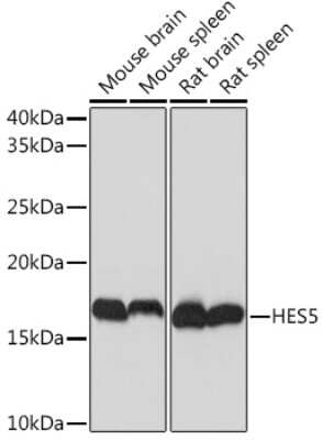 Western Blot: HES5 Antibody (4S4U7) [NBP3-16880] - Analysis of extracts of various cell lines, using HES5 Rabbit mAb (NBP3-16880) at 1:1000 dilution. Secondary antibody: HRP Goat Anti-Rabbit IgG (H+L) at 1:10000 dilution. Lysates/proteins: 25ug per lane. Blocking buffer: 3% nonfat dry milk in TBST. Detection: ECL Basic Kit. Exposure time: 1s.