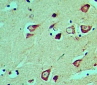 Immunohistochemistry-Paraffin HES5 Antibody