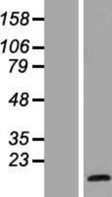 Western Blot: HES5 Overexpression Lysate (Adult Normal) [NBL1-11512] Left-Empty vector transfected control cell lysate (HEK293 cell lysate); Right -Over-expression Lysate for HES5.