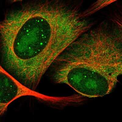 Immunocytochemistry/Immunofluorescence: HES6 Antibody [NBP2-57558] - Staining of human cell line U-2 OS shows localization to nucleoli, nuclear bodies & cytosol. Antibody staining is shown in green.