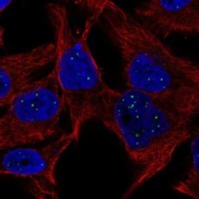 Immunocytochemistry/Immunofluorescence: HES6 Antibody [NBP3-17721] - Staining of human cell line SK-MEL-30 shows localization to nuclear bodies.