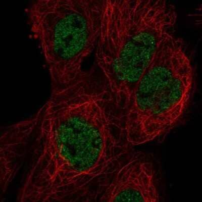 Immunocytochemistry/Immunofluorescence: HES7 Antibody [NBP2-49675] - Staining of human cell line A-431 shows localization to nucleoplasm.