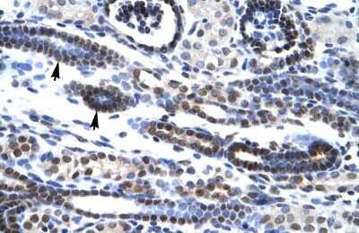 Immunohistochemistry-Paraffin: HES7 Antibody [NBP2-85042] - Rabbit Anti-HES7 Antibody. Paraffin Embedded Tissue: Human Kidney. Cellular Data: Epithelial cells of renal tubule. Antibody Concentration: 4.0-8.0 ug/ml. Magnification: 400X