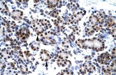 Immunohistochemistry-Paraffin: HES7 Antibody [NBP2-85042] - Rabbit Anti-HES7 Antibody. Paraffin Embedded Tissue: Human Pancreas. Cellular Data: Epithelial cells of pancreatic acinus. Antibody Concentration: 4.0-8.0 ug/ml. Magnification: 400X